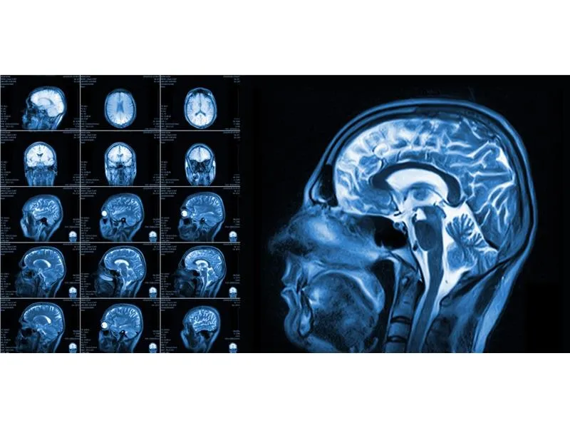 Fizjoterapeuta a rezonans magnetyczny (MRI): kto wystawia skierowanie?