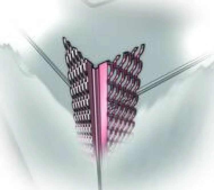 Jakie narożniki do tynków gipsowych wybrać, aby uniknąć problemów?