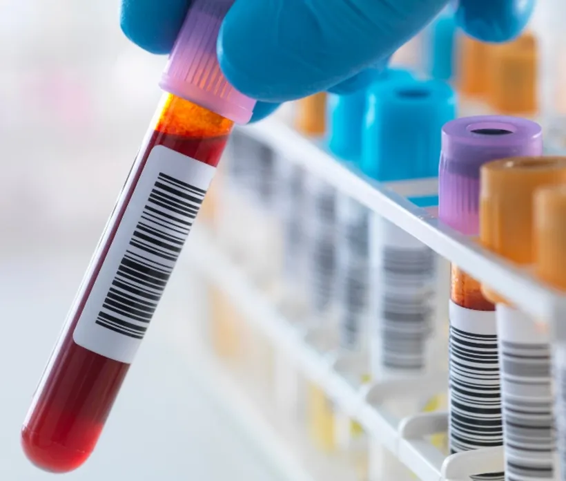 Podwyższone leukocyty: co oznaczają i kiedy szukać pomocy?