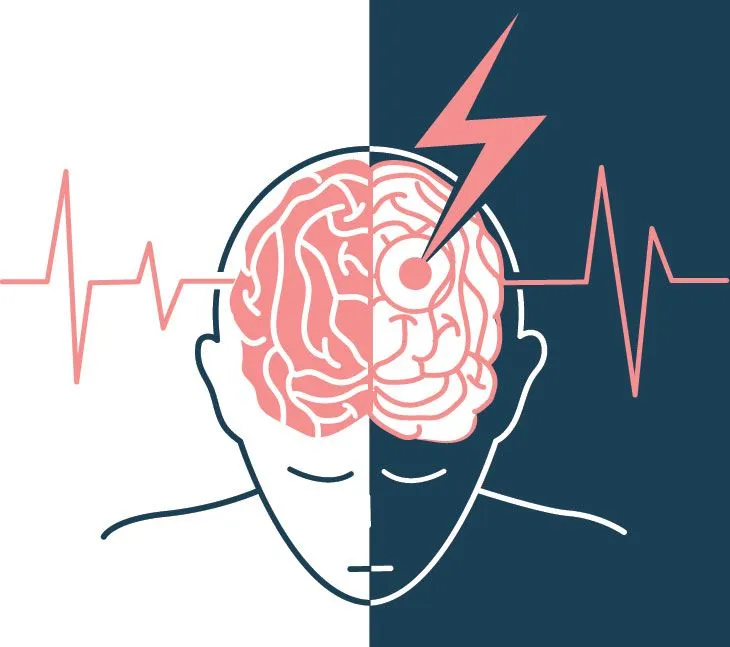 Przyczyny i objawy udaru niedokrwiennego – jak rozpoznać i zapobiec zagrożeniu