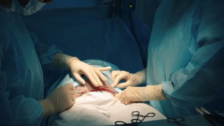 Cesarskie cięcie: Prawda o nazwie to prawo, nie narodziny Cezara