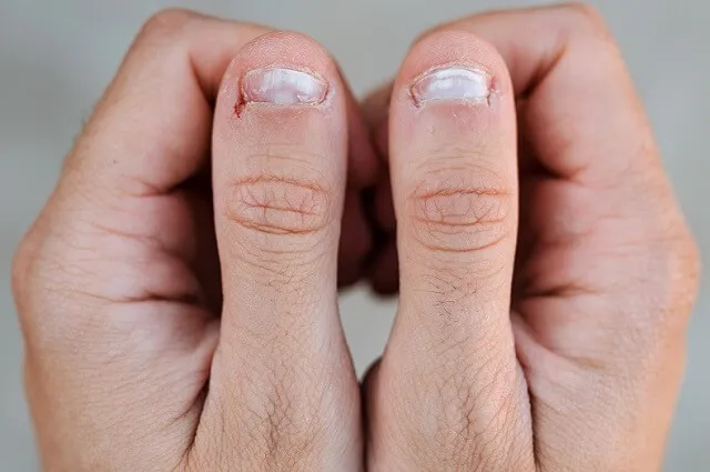 Jak pobudzić macierz paznokcia i przywrócić ich zdrowy wygląd Jak pobudzić macierz paznokcia i przywrócić ich zdrowy wygląd