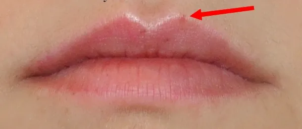 Jak zażywać heviran przed makijażem permanentnym ust, aby uniknąć problemów