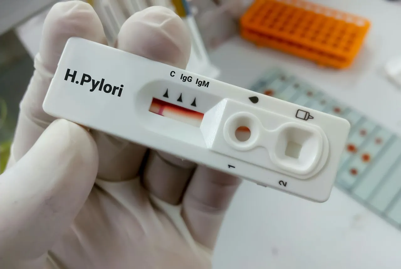 Opinie o leczeniu Helicobacter pylori: Forum dyskusyjne