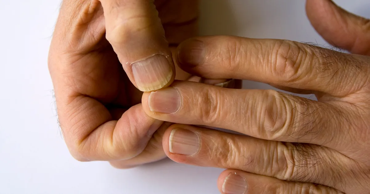 Jak odrasta paznokieć? Poznaj czas regeneracji i skuteczną pielęgnację Jak odrasta paznokieć? Poznaj czas regeneracji i skuteczną pielęgnację