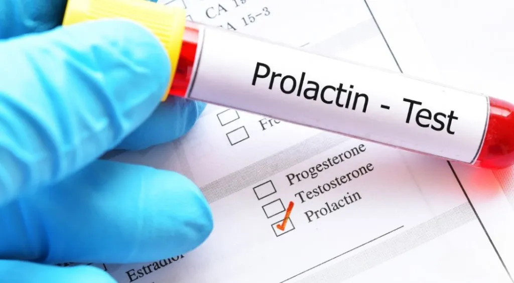 Jak badać prolaktynę, aby uzyskać wiarygodne wyniki?