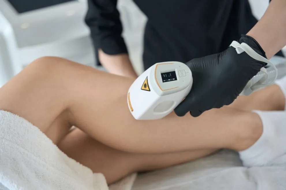 Ile razy trzeba zrobić depilację laserową, aby uzyskać trwałe efekty? Ile razy trzeba zrobić depilację laserową, aby uzyskać trwałe efekty?