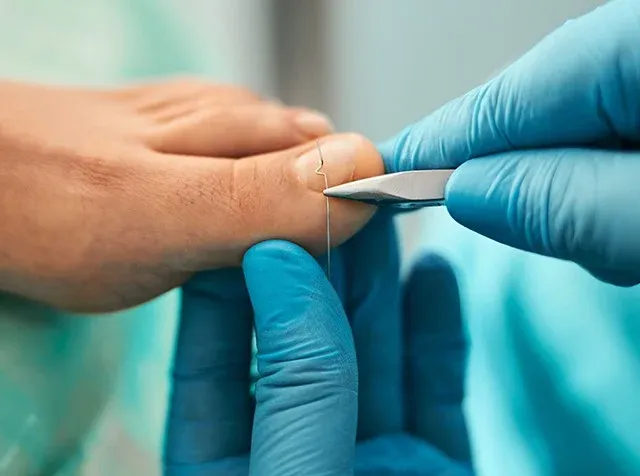 Czy podolog jest na NFZ w Krakowie? Sprawdź dostępne usługi bez kosztów