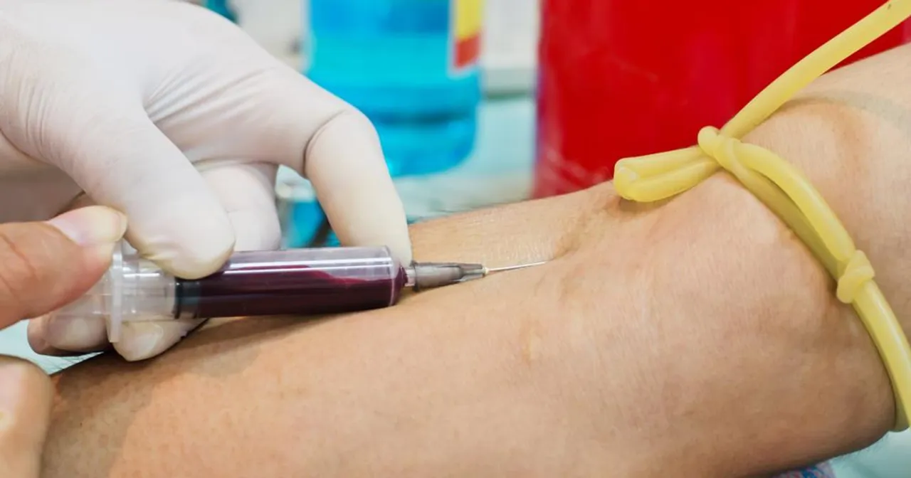 Jak przygotować się do badania cholesterolu, aby uniknąć błędów