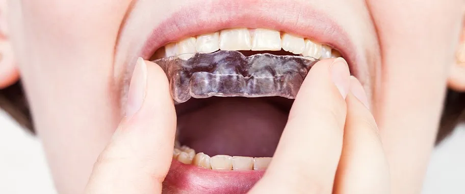 Jakie leki na bruksizm skutecznie łagodzą objawy i bóle?