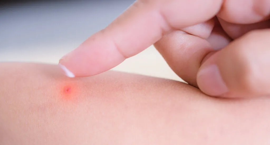 Jak pozbyć się kropek po goleniu i cieszyć się gładką skórą