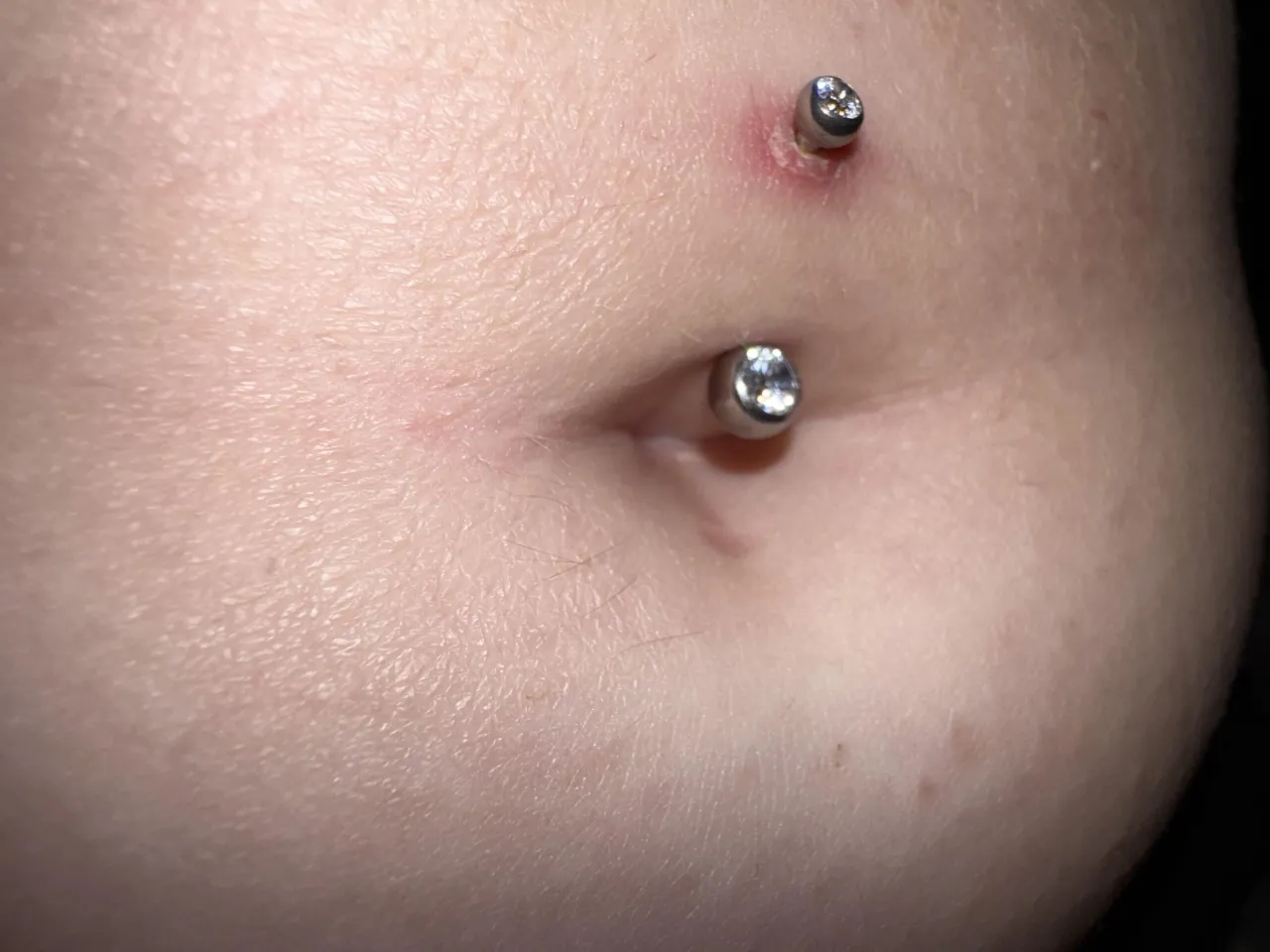 Jak przyspieszyć gojenie kolczyka w pepku i uniknąć infekcji