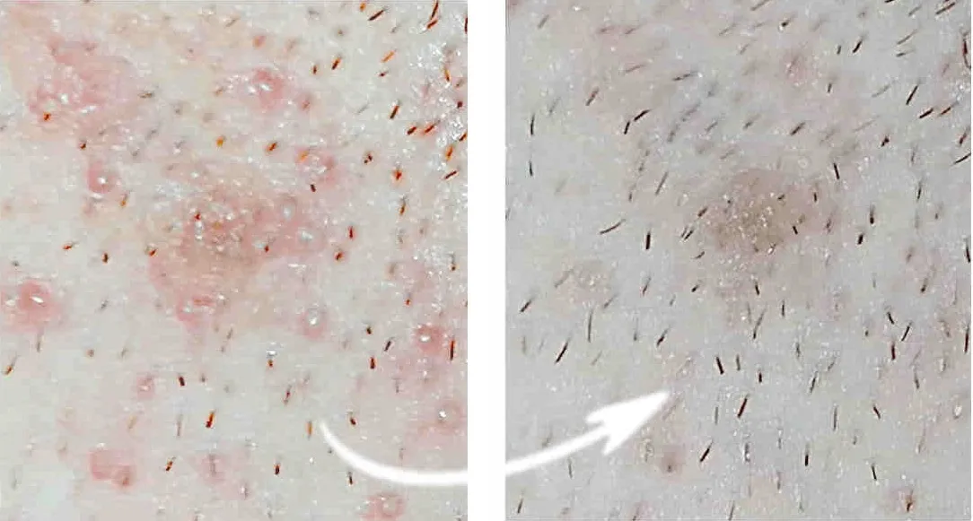 Woda po goleniu po co? Odkryj jej niespodziewane korzyści dla skóry