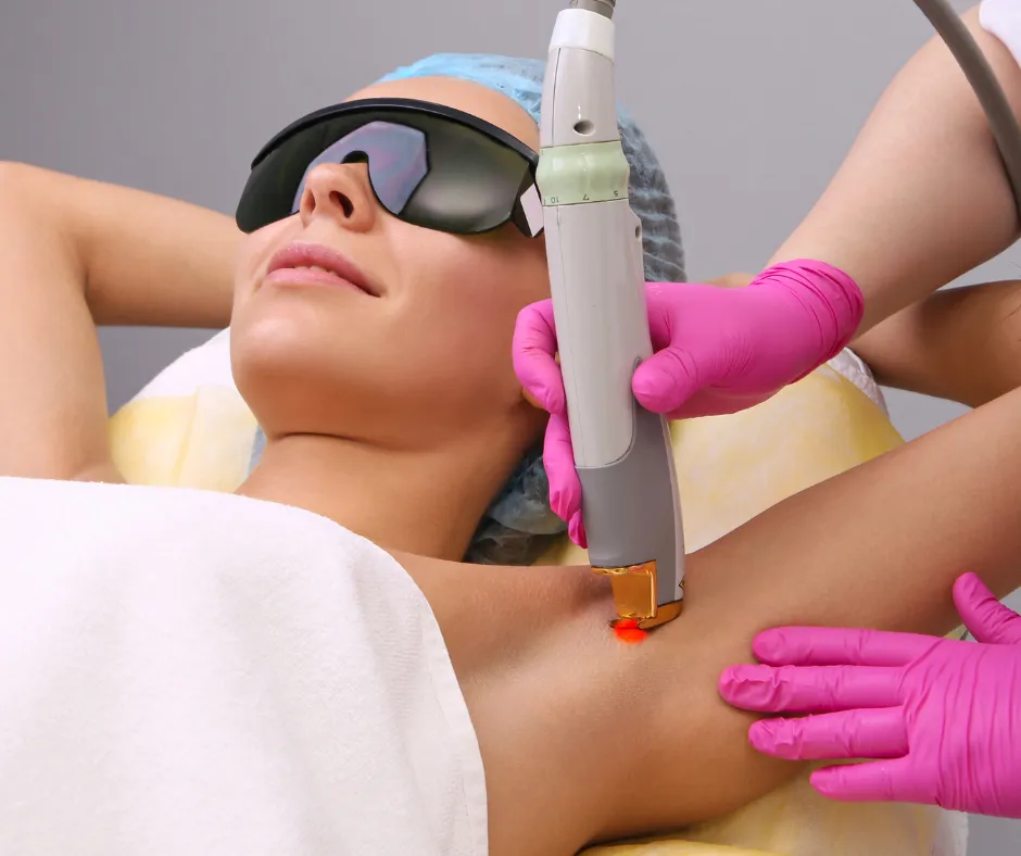 Czy po depilacji laserowej można się opalać? Uniknij niepożądanych skutków