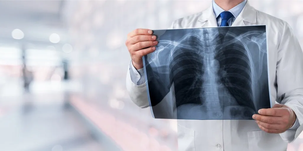 Woda w płucach przyczyna: Co może zagrażać Twojemu zdrowiu?