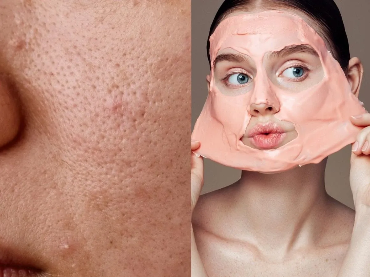 Jak wygląda zapchana cera? Poznaj objawy i sposoby leczenia