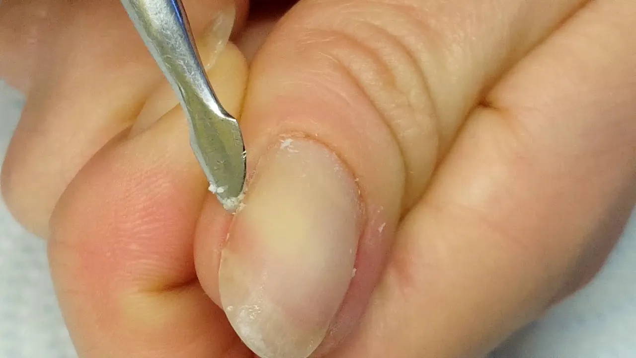 Jak obciąć skórki na paznokciach bez ryzyka uszkodzenia?