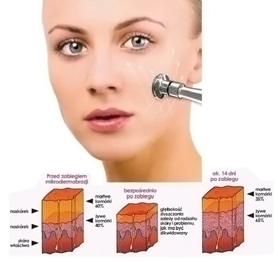 Ile trwa zabieg mikrodermabrazji? Czas, który warto znać przed wizytą