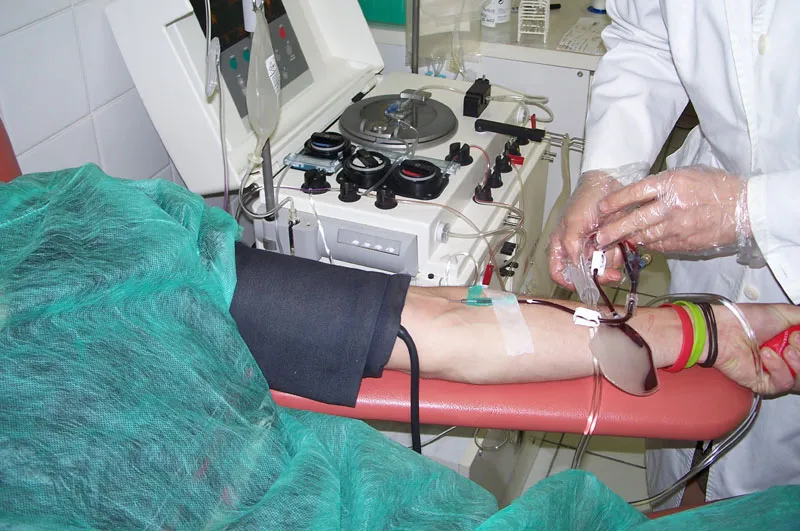 Co ile można oddać płytki krwi? Poznaj częstotliwość donacji