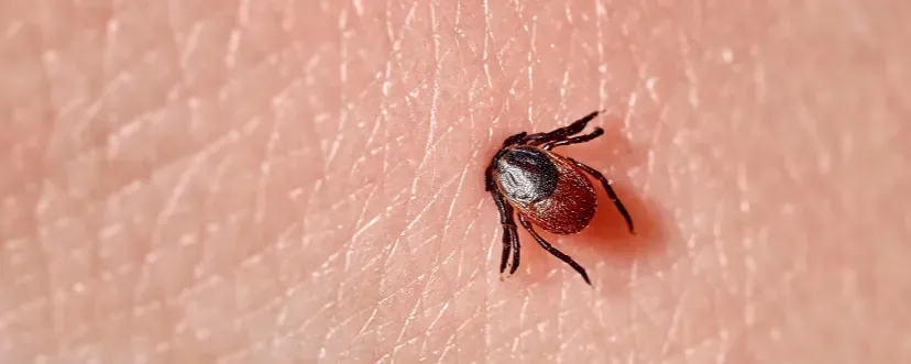 Objawy ugryzienia kleszcza – jak rozpoznać niebezpieczne sygnały