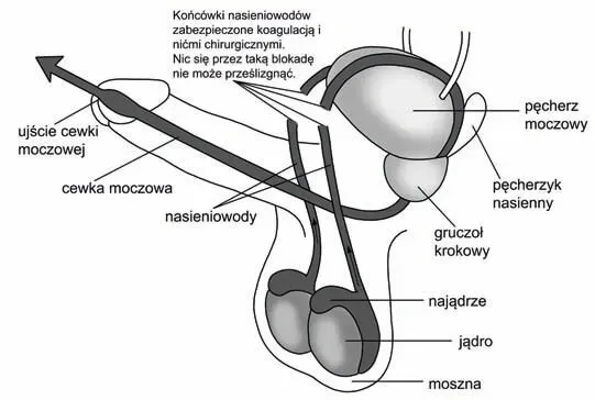 Czy wazektomia to grzech? Moralne dylematy i nauka Kościoła