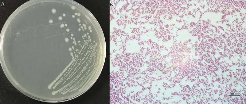 Morganella: objawy i metody leczenia tej niebezpiecznej bakterii.