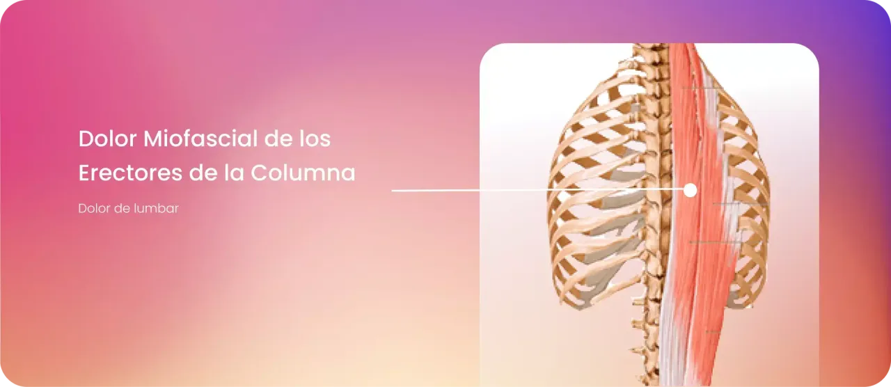 Músculos erector de la columna: su importancia para la salud lumbar