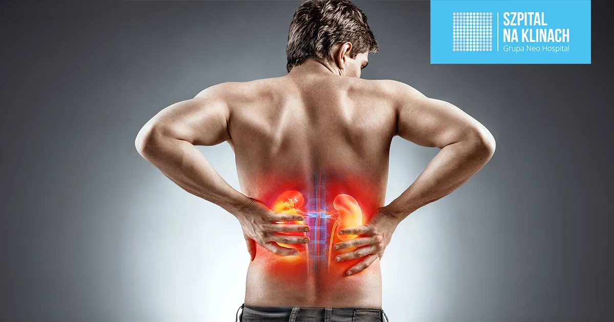 Kamica nerkowa: poznaj przyczyny i uniknij bólu kamieni nerkowych