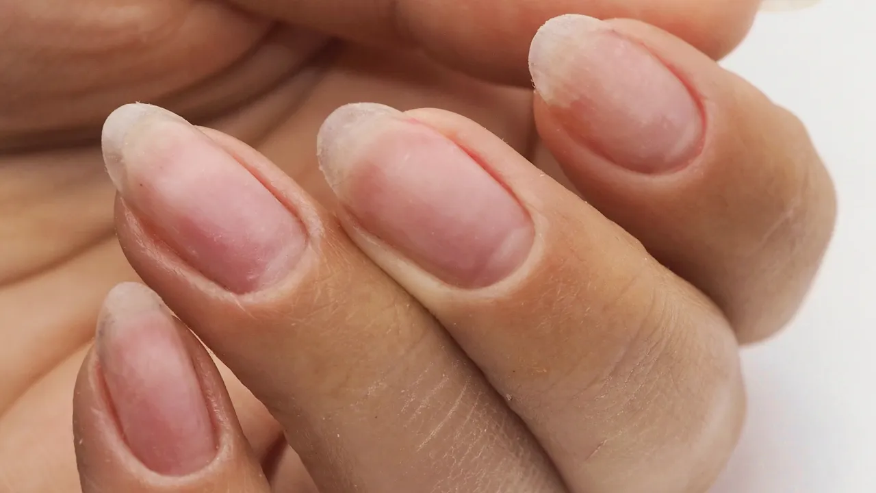 Jak szybko zapuścić paznokcie? Sprawdzone sposoby i porady