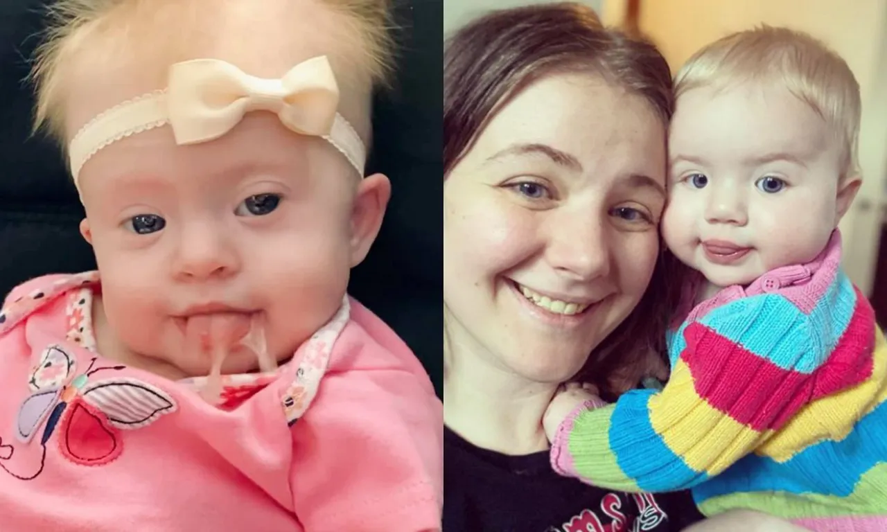 Czy urodzić dziecko z zespołem Downa? Ważne ryzyka i decyzje