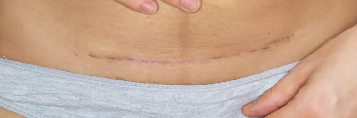 Czy cięcie się to grzech? Zrozumienie moralnych konsekwencji