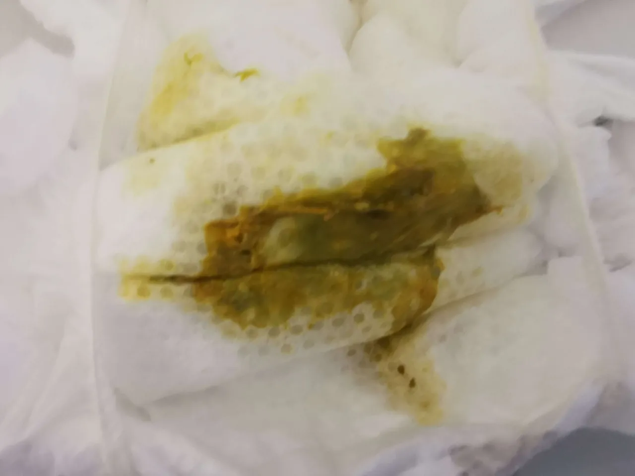 Jak wyglądają kupki przy ząbkowaniu? Co powinno niepokoić rodziców?