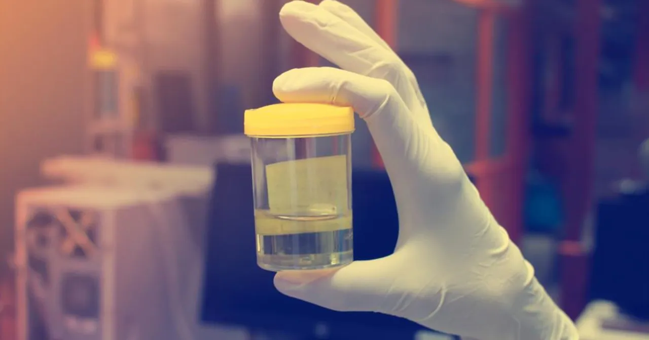 Czy w badaniu moczu wyjdzie nikotyna? Oto co musisz wiedzieć Czy w badaniu moczu wyjdzie nikotyna? Oto co musisz wiedzieć