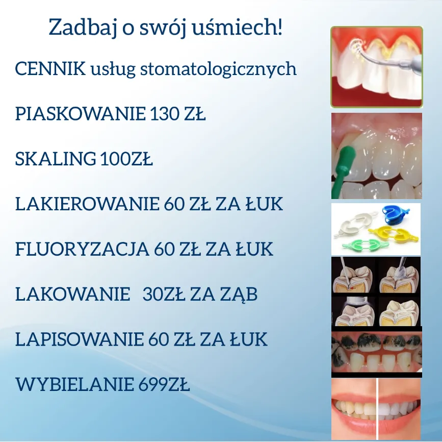 Ile kosztuje wyrwanie zęba w Polsce? Ceny i porównanie NFZ