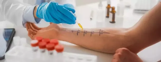 Alergia na leki? Gdzie i jak wykonać testy w Polsce + koszty