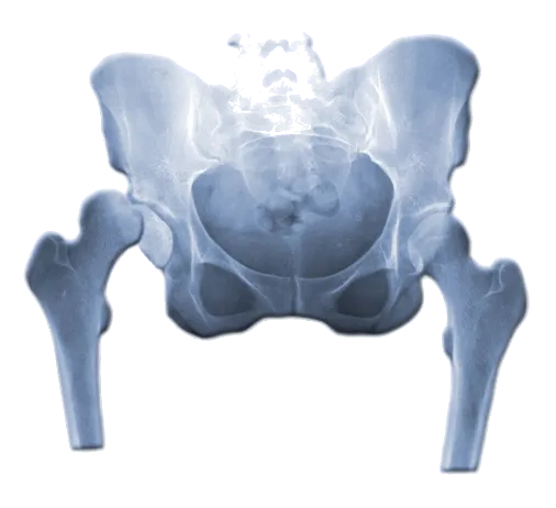 Skręcenie stawu biodrowego objawy – jak je rozpoznać i leczyć