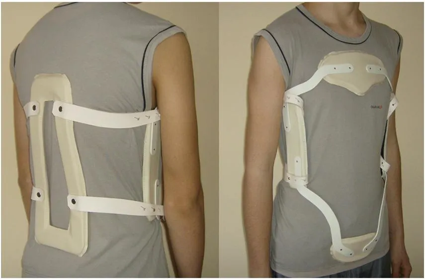 Gorset ortopedyczny przy złamaniu kręgosłupa - kluczowe informacje