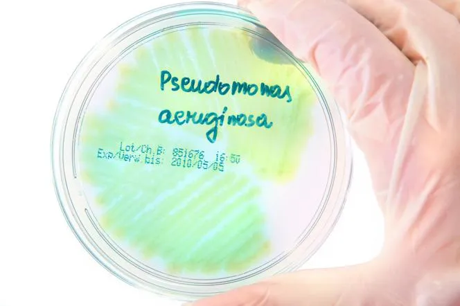 Pseudomonas aeruginosa w moczu: Co oznacza dla Twojego zdrowia?