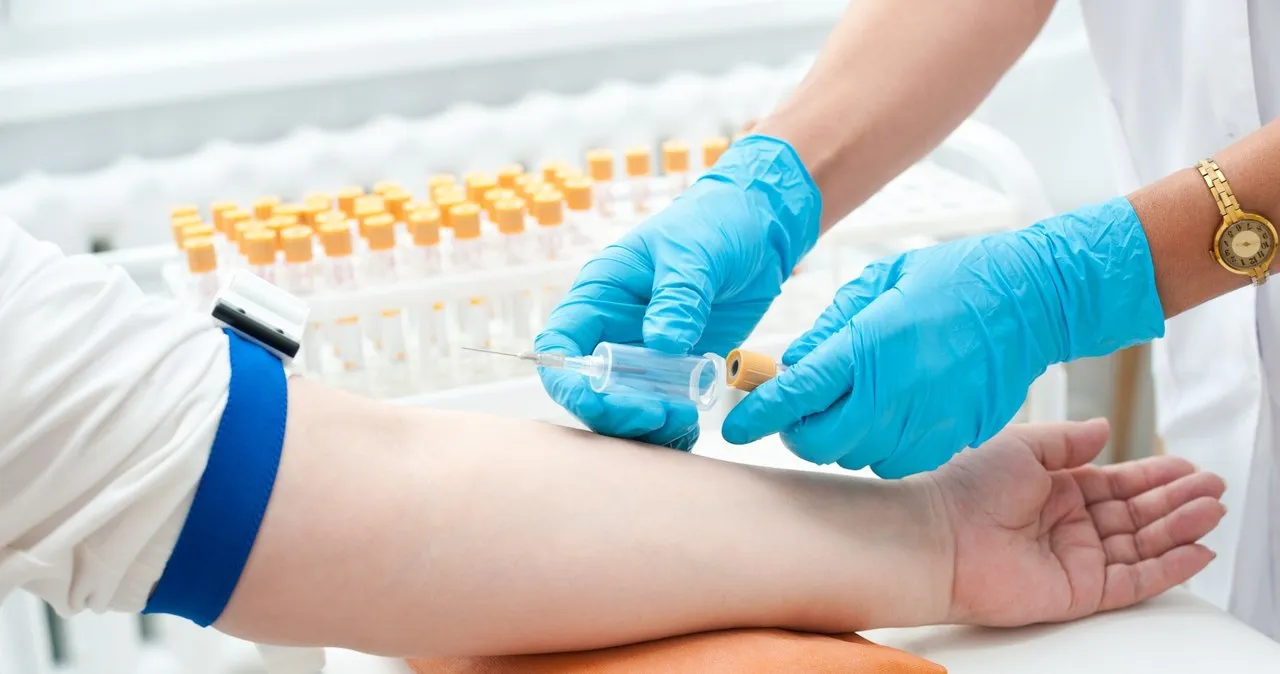 Czy można pić wodę przed badaniem kreatyniny? Sprawdź, co musisz wiedzieć