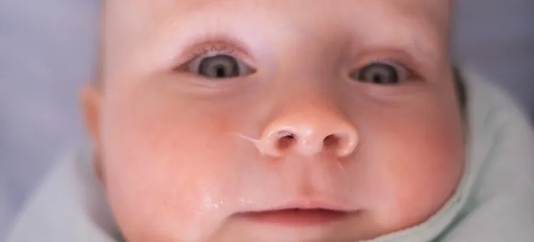 Skuteczne sposoby na katar dla 5 miesięcznego dziecka, które pomogą