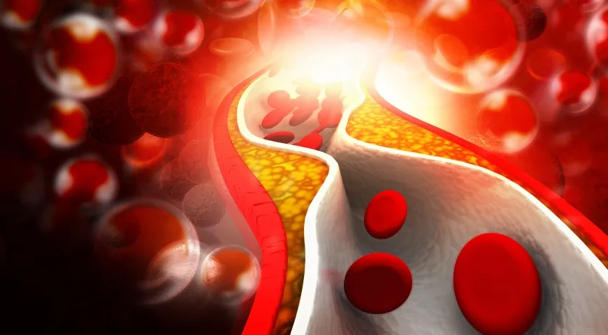 Czy omega 3 obniża cholesterol? Sprawdź, jak wpływa na LDL i HDL