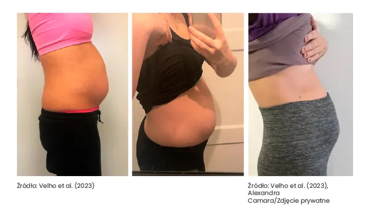 Blog o endometriozie: Życie, wsparcie i najnowsze informacje