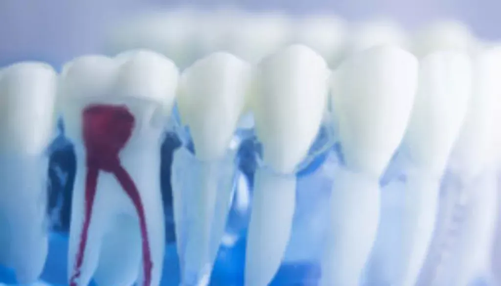 Ile kanałów ma ząb 6? Zaskakujące różnice w budowie zębów