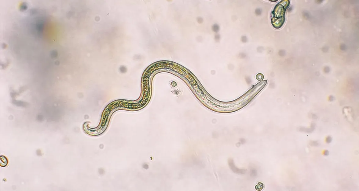 Czy masz pasożyty? Oto 7 alarmujących objawów do sprawdzenia