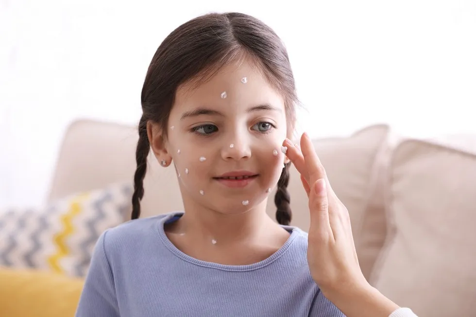 Jak bezpiecznie kąpać dziecko z ospą - unikaj podrażnień i bólu