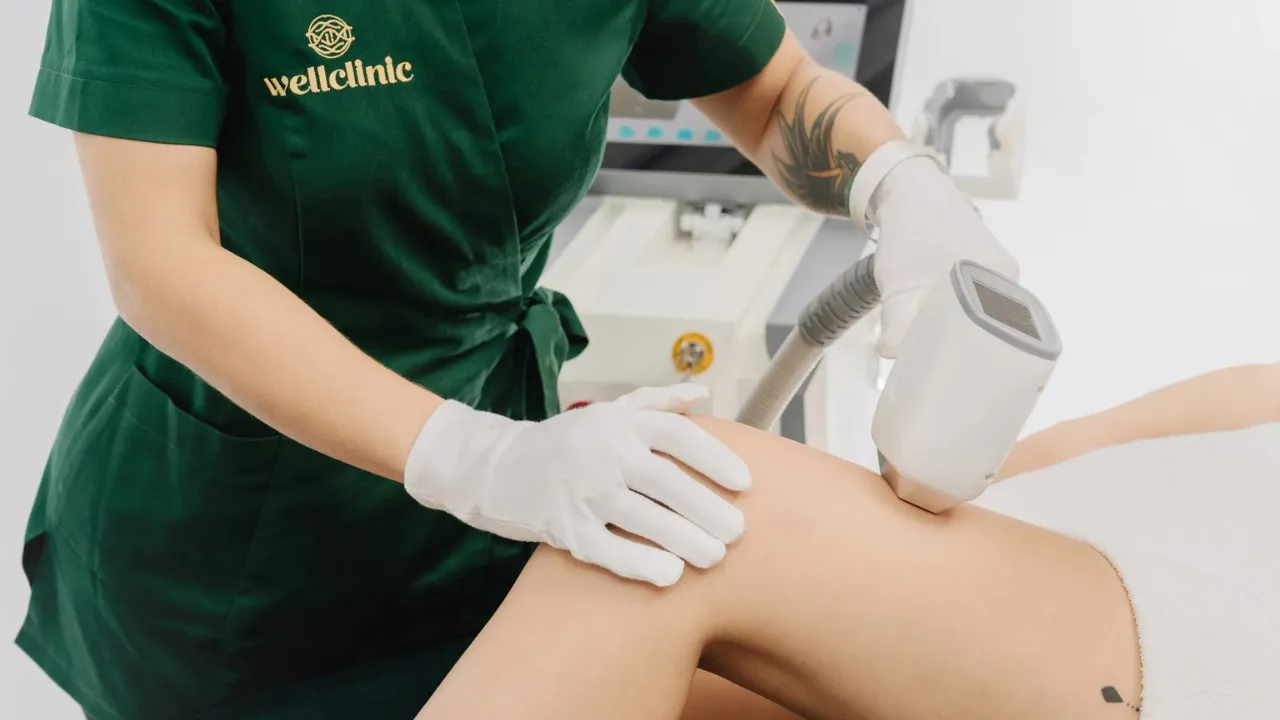 Depilacja laserowa co ile zabiegi – poznaj optymalne odstępy