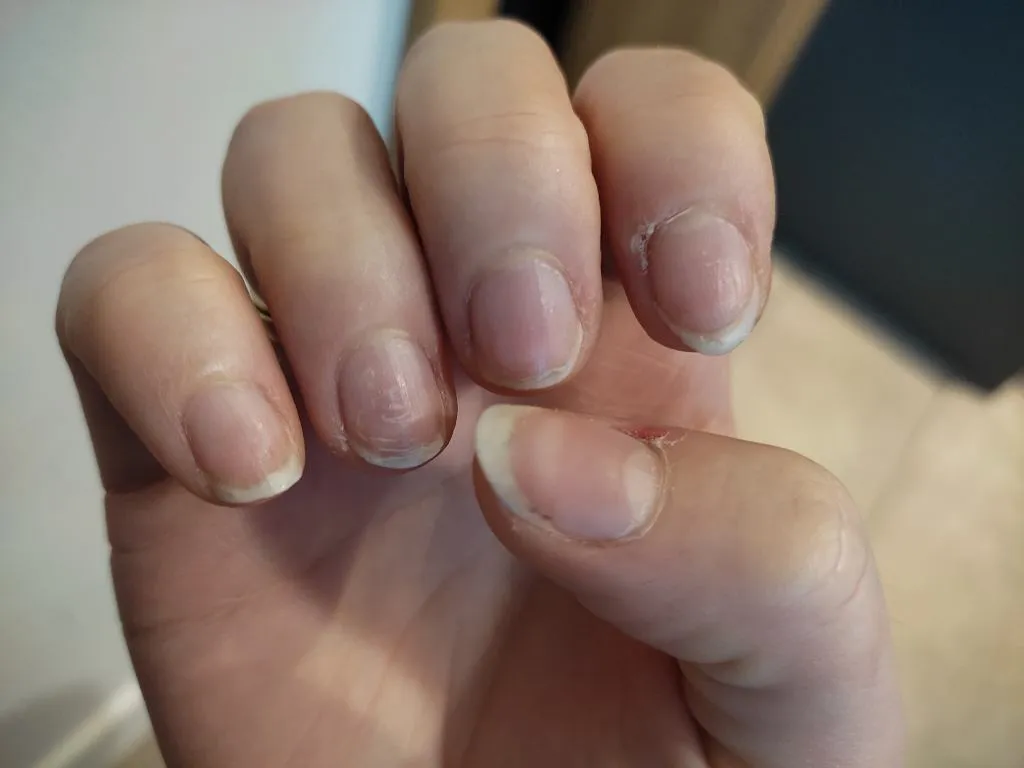 Jaki manicure wybrać, aby uniknąć zniszczenia paznokci?