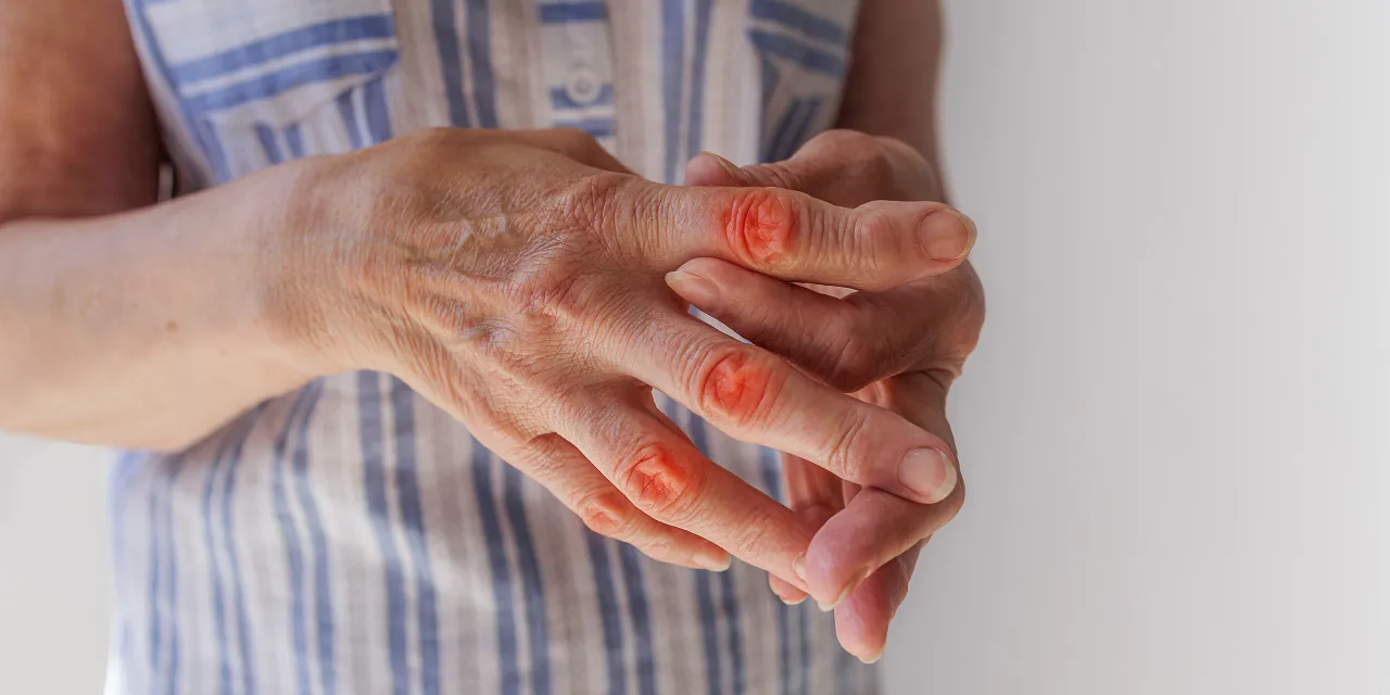 Obrzęk stawów: przyczyny i skuteczne metody w różnych przypadkach.