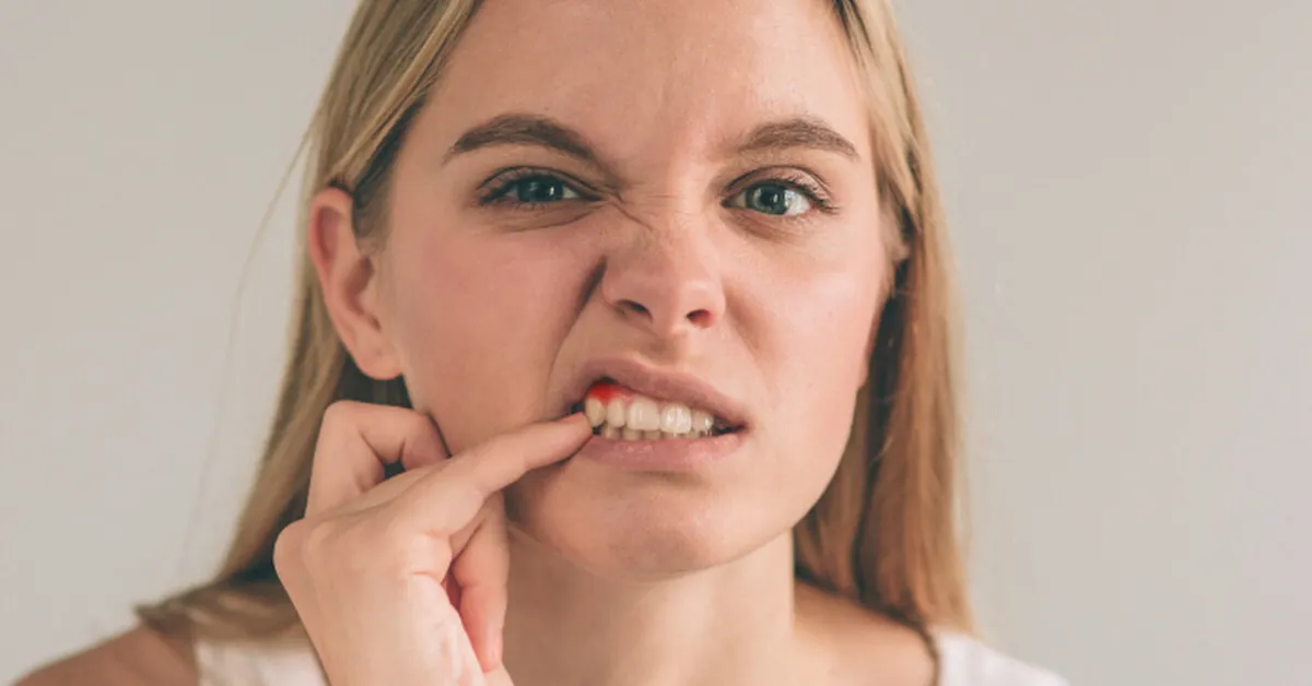 Bezpieczne sposoby na ból dziąseł w ciąży – jak złagodzić dyskomfort bez ryzyka