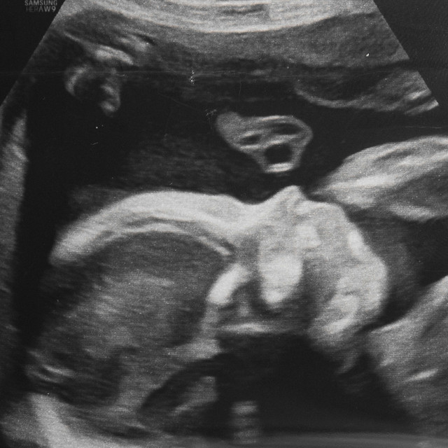 Mia • Cały album • Wszystkie utwory • Wykonawca